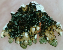 Parmeliopsis hyperopta