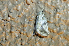 Diastema