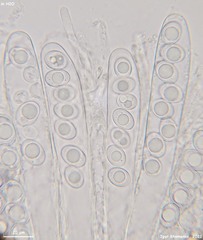 Trichophaea woolhopeia