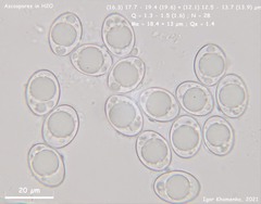 Trichophaea woolhopeia