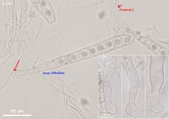 Trichophaea woolhopeia