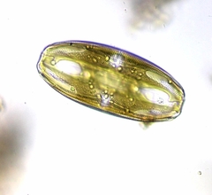 Amphora ovalis