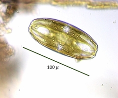 Amphora ovalis