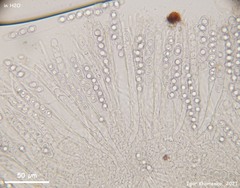 Trichophaea woolhopeia