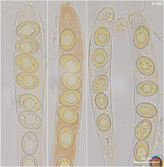Trichophaea woolhopeia