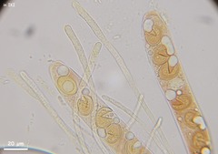 Trichophaea woolhopeia