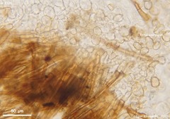 Trichophaea woolhopeia