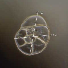 Heronallenia lingulata