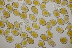Puccinia graminis
