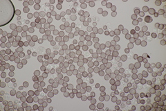 Microbotryum stellariae