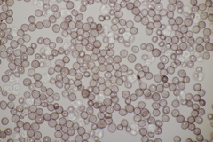 Microbotryum stellariae