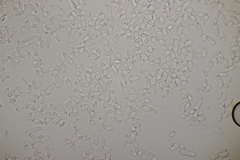 Ramularia cupulariae