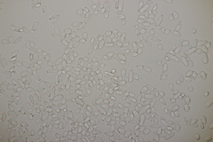 Ramularia cupulariae