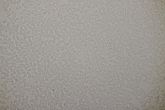 Ramularia cupulariae