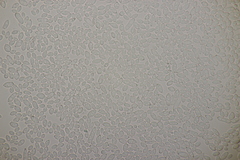 Ramularia cupulariae