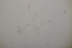 Fomitiporia hippophaeicola