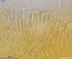 Orbilia xanthostigma