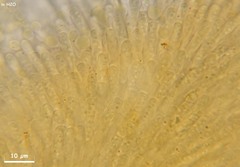 Orbilia xanthostigma