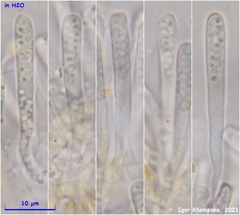 Orbilia xanthostigma