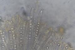Pulvinula archeri