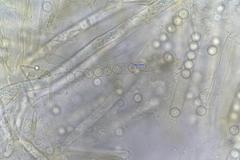 Plicaria endocarpoides