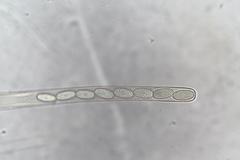 Peziza echinospora