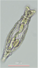 Philodina duplicalcar