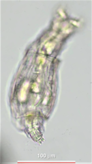 Philodina duplicalcar