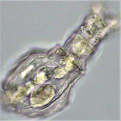 Philodina duplicalcar