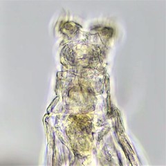 Philodina duplicalcar
