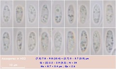 Hymenoscyphus calyculus