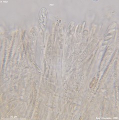 Hymenoscyphus calyculus