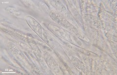 Hymenoscyphus calyculus