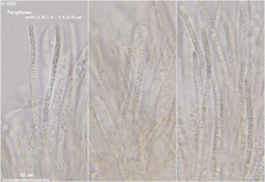 Hymenoscyphus calyculus
