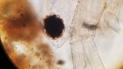 Simocephalus serrulatus