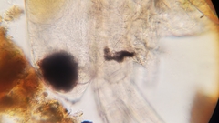 Simocephalus serrulatus