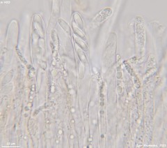 Hymenoscyphus imberbis