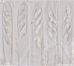 Hymenoscyphus imberbis