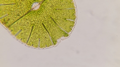 Micrasterias denticulata