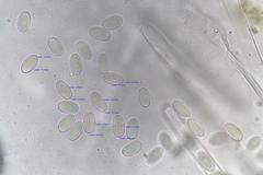 Cheilymenia coprinaria