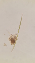 Closterium aciculare