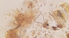 Staurastrum punctulatum