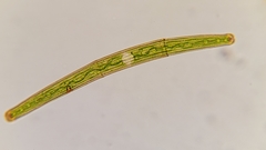 Closterium striolatum