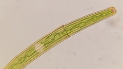 Closterium striolatum