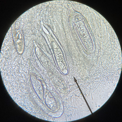 Pertusaria consocians