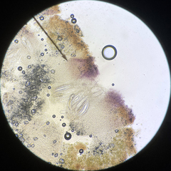 Pertusaria consocians