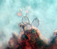 Trechispora mollusca