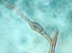 Trechispora mollusca