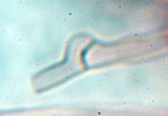 Trechispora mollusca