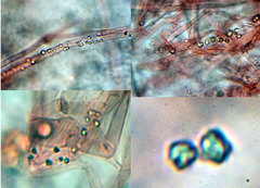 Trechispora mollusca